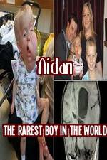 Watch Aidan The Rarest Boy In The World Vodlocker