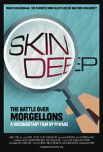 Watch Skin Deep: The Battle Over Morgellons Vodlocker