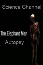 Watch Science Channel Elephant Man Autopsy Vodlocker