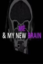 Watch Me & My New Brain Vodlocker