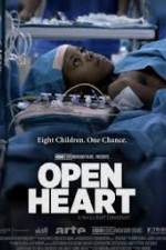 Watch Open Heart Vodlocker