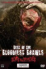 Watch TNA Wrestling: Best of the Bloodiest Brawls - Scars and Stitches Vodlocker