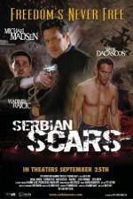 Watch Serbian Scars Vodlocker
