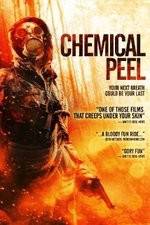 Watch Chemical Peel Vodlocker