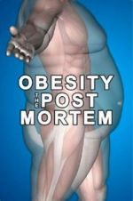 Watch Obesity: The Post Mortem Vodlocker