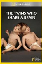 Watch National Geographic The Twins Who Share A Brain Vodlocker