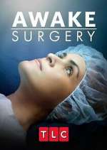 Watch Awake Surgery Vodlocker